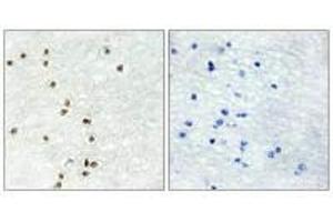 Immunohistochemistry analysis of paraffin-embedded human brain tissue using ZIC1/2/3 antibody. (ZIC1 抗体)