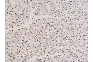 ABIN6267073 at 1/100 staining human duodenum tissue sections by IHC-P. (CHEK1 抗体  (pSer280))