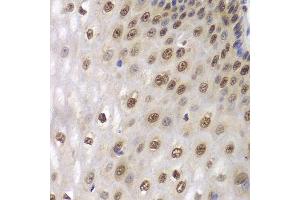 Immunohistochemistry of paraffin-embedded human esophagus using DDX5 antibody. (DDX5 抗体  (AA 1-614))