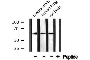 Western Blotting (WB) image for anti-CDK5 Regulatory Subunit Associated Protein 1-Like 1 (CDKAL1) (N-Term) antibody (ABIN6259603)