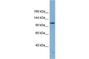 WB Suggested Anti-DHX15 Antibody Titration:  0. (DHX15 抗体  (N-Term))