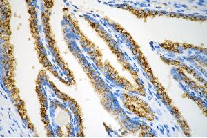 anti-Arginase, Type II (ARG2) antibody