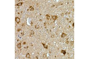 Immunohistochemistry (IHC) image for anti-phosphoribosyl Pyrophosphate Synthetase-Associated Protein 2 (PRPSAP2) (AA 1-90) antibody (ABIN7269365)