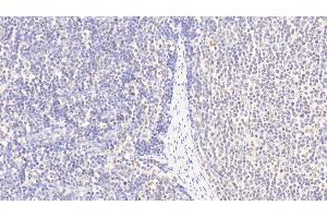 Immunohistochemistry (IHC) image for anti-Histone Cluster 2, H3a (HIST2H3A) (AA 1-136) antibody (ABIN7439000)
