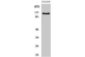 Western Blotting (WB) image for anti-RhoGEF p115 (Internal Region) antibody (ABIN3177221) (RhoGEF p115 (Internal Region) 抗体)