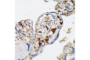 Immunohistochemistry of paraffin-embedded human placenta using Fibrinogen alpha chain (FGA) (FGA) Rabbit mAb (ABIN7267177) at dilution of 1:100 (40x lens). (FGA 抗体)
