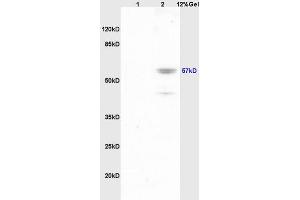 Lane 1: mouse brain lysates Lane 2: mouse lung lysates probed with Anti Phospho-Lyn (Tyr507) Polyclonal Antibody, Unconjugated (ABIN743603) at 1:200 in 4 °C. (LYN 抗体  (pTyr508))
