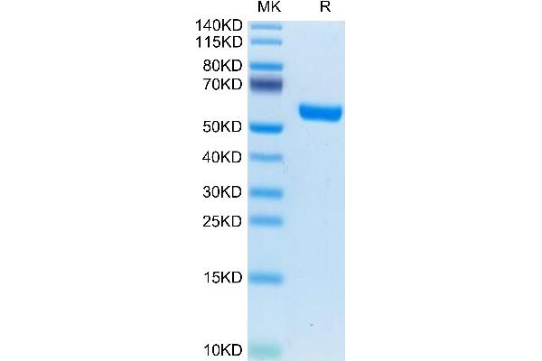 IL-19 Protein (AA 25-177) (Fc Tag)