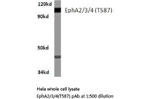 Western blot (WB) analysis of EphA2/3/4 antibody in extracts from Hela cells. (EPH Receptor A2 抗体)