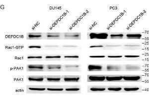 DEPDC1B regulates the Rho signaling pathway and binds to Rac1. (PAK1 抗体  (AA 1-240))