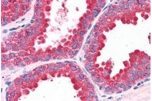 Human Prostate (formalin-fixed, paraffin-embedded) stained with DUSP1 antibody ABIN351458 at 3. (DUSP1 抗体  (AA 355-367))