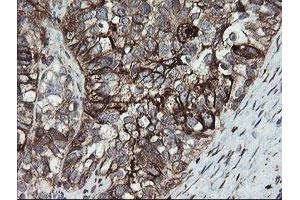 Image no. 3 for anti-Protein Disulfide Isomerase Family A, Member 3 (PDIA3) antibody (ABIN1498107)