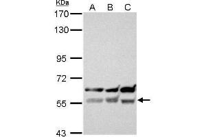 Western Blotting (WB) image for anti-X-Linked Inhibitor of Apoptosis (XIAP) (C-Term) antibody (ABIN2854771)