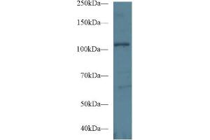 Western Blot; Sample: Human Hela cell lysate; Primary Ab: 1µg/ml Rabbit Anti-Mouse EPHA1 Antibody Second Ab: 0. (EPHA1 抗体  (AA 716-960))