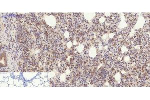Immunohistochemistry of paraffin-embedded Rat lung tissue using YAP1 Polyclonal Antibody at dilution of 1:200. (YAP1 抗体)