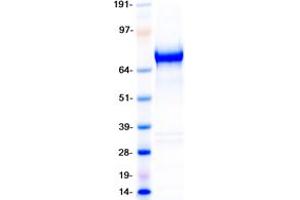 Western Blotting (WB) image for Low Density Lipoprotein Receptor-Related Protein 8, Apolipoprotein E Receptor (LRP8) (Transcript Variant 3) protein (Myc-DYKDDDDK Tag) (ABIN2714816)