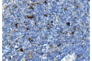 IHC analysis of Ccr2 using anti-Ccr2 antibody (ABIN7602745).