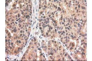 Image no. 12 for anti-Myc Proto-Oncogene protein (MYC) antibody (ABIN1497011) (c-MYC 抗体)