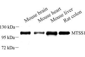 Western blot analysis of MTSS1 (ABIN7074604) at dilution of 1: 500 (MTSS1 抗体)