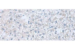 Immunohistochemistry (Paraffin-embedded Sections) (IHC (p)) image for anti-ATPase, H+ Transporting, Lysosomal 42kDa, V1 Subunit C1 (ATP6V1C1) antibody (ABIN7247105)