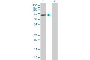 Western Blot analysis of MAP3K7 expression in transfected 293T cell line by MAP3K7 MaxPab polyclonal antibody. (MAP3K7 抗体  (AA 1-579))