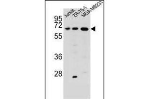 ZSCAN2 Antibody (N-term) (ABIN657010 and ABIN2846190) western blot analysis in Jurkat,ZR-75-1,MDA-M cell line lysates (35 μg/lane). (ZSCAN2 抗体  (N-Term))