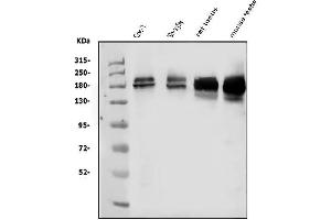 Western blot analysis of KDM5B using anti-KDM5B antibody (ABIN4886648).