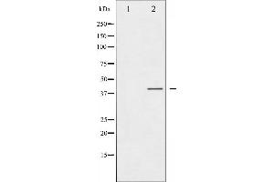 Western blot analysis of CCR5 phosphorylation expression in Jurkat whole cell lysates,The lane on the left is treated with the antigen-specific peptide. (CCR5 抗体  (pSer336))