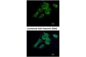ICC/IF Image Immunofluorescence analysis of methanol-fixed Hep3B, using HSD17B4, antibody at 1:500 dilution. (HSD17B4 抗体)