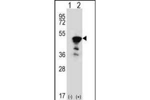 Western blot analysis of FEN1 (arrow) using rabbit polyclonal FEN1 Antibody (Center) (ABIN389376 and ABIN2839472). (FEN1 抗体  (AA 243-272))