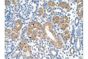 Image no. 1 for anti-Fumarylacetoacetate Hydrolase (Fumarylacetoacetase) (FAH) (AA 311-360) antibody (ABIN320667) (FAH 抗体  (AA 311-360))