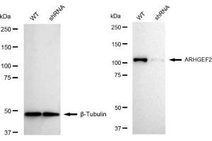 Western blotting analysis using ARHGEF2 antibody (ABIN7800207).