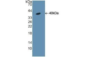 Detection of Recombinant KRT18, Rat using Polyclonal Antibody to Cytokeratin 18 (CK18) (Cytokeratin 18 抗体  (AA 72-380))