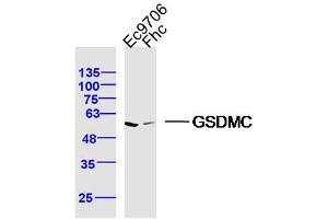 Lane 1: Ec9706 lysates Lane 2: FHC lysates probed with GSDMC Polyclonal Antibody, Unconjugated  at 1:300 dilution and 4˚C overnight incubation. (MLZE 抗体  (AA 1-100))