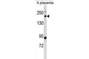 BCL9L Antibody (N-term) (ABIN1881110 and ABIN2838843) western blot analysis in human placenta tissue lysates (35 μg/lane). (BCL9L 抗体  (N-Term))