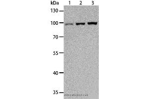 Western blot analysis of Hela, Raji and K562 cell, using TLR3 Polyclonal Antibody at dilution of 1:500 (TLR3 抗体)