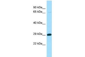 WB Suggested Anti-STARD6 Antibody Titration: 1. (STARD6 抗体  (N-Term))