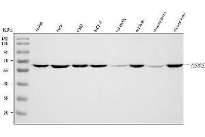 Western blot analysis of Asparagine synthetase/ASNS using anti-Asparagine synthetase/ASNS antibody (ABIN7599465).