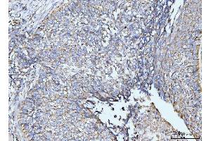 IHC analysis of GRPEL1 using anti-GRPEL1 antibody (ABIN7602643). (GRPEL1 抗体  (AA 90-217))