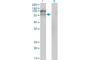 Western Blot analysis of HGS expression in transfected 293T cell line by HGS monoclonal antibody (M01), clone 6D11. (HGS 抗体  (AA 513-612))