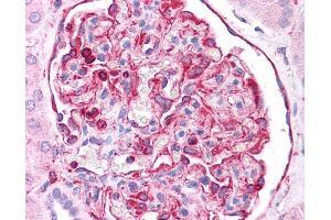 Immunohistochemistry (IHC) image for anti-Vimentin (VIM) (C-Term) antibody (ABIN2783289)