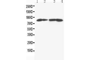 Anti-MTA1 antibody, Western blotting Lane 1: MCF-7 Cell Lysate Lane 2: HELA Cell Lysate Lane 3: JURKAT Cell Lysate Lane 4: CEM Cell Lysate (MTA1 抗体  (C-Term))