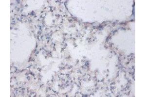 IHC analysis of paraffin-embedded human lung tissue using Diamine acetyltransferase 1 Antibody (1/100 dilution). (SAT1 抗体  (AA 5-171))