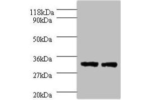 Western blot All lanes: HLA-DPA1 antibody at 2 μg/mL Lane 1: 293T whole cell lysate Lane 2: HepG2 whole cell lysate Secondary Goat polyclonal to rabbit IgG at 1/10000 dilution Predicted band size: 30 kDa Observed band size: 30 kDa (HLA-DPA1 抗体  (AA 29-222))