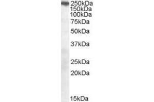 Western Blotting (WB) image for anti-Sortilin-Related Receptor, L(DLR Class) A Repeats Containing (SORL1) (AA 2203-2214) antibody (ABIN297696) (SORL1 抗体  (AA 2203-2214))