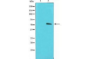 Western blot analysis on LOVO cell lysate using GLUT3 Antibody,The lane on the left is treated with the antigen-specific peptide. (SLC2A3 抗体  (C-Term))