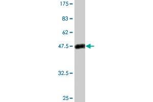 Western Blot detection against Immunogen (50. (PSPH 抗体  (AA 1-225))