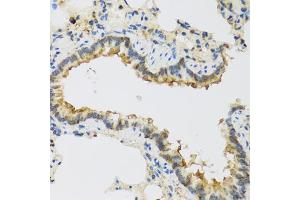 Immunohistochemistry of paraffin-embedded rat lung using FAM20A antibody. (FAM20A 抗体)