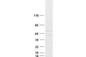 Western Blotting (WB) image for Carbohydrate (Chondroitin 4) Sulfotransferase 12 (CHST12) protein (Myc-DYKDDDDK Tag) (ABIN2714186)