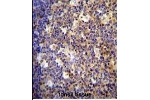 Immunohistochemistry (Paraffin-embedded Sections) (IHC (p)) image for anti-Arachidonate 12-Lipoxygenase, 12R Type (ALOX12B) (AA 622-652), (C-Term) antibody (ABIN654058)